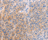Anti-Human/Mouse/Rat ADHFE1 Antibody - ABMIUM