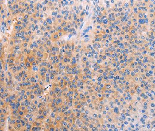 Anti-Human/Mouse/Rat ADHFE1 Antibody