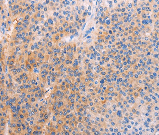 Anti-Human/Mouse/Rat ADHFE1 Antibody - ABMIUM