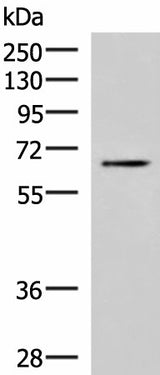 Western blot analysis of Jurkat cell lysate using BRD9 Polyclonal Antibody at dilution of 1:800