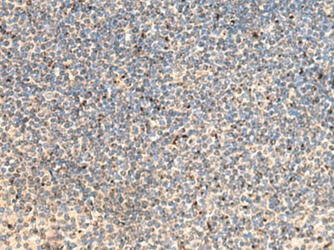 Immunohistochemistry of paraffin-embedded Human tonsil tissue using PTH1R Polyclonal Antibody at dilution of 1:65(×200)