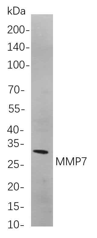 Anti-Human MMP7 Antibody [B789] - ABMIUM