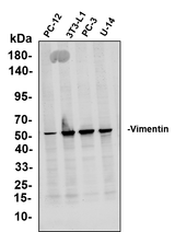 Anti-Human/Mouse/Rat Vimentin Antibody [B793]