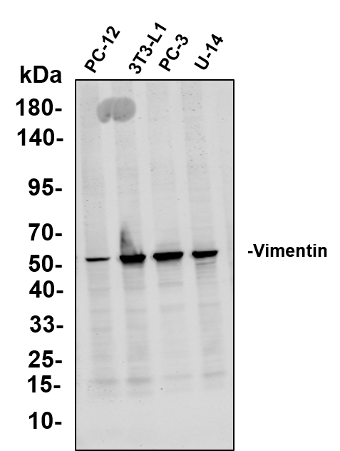 Anti-Human/Mouse/Rat Vimentin Antibody [B793] - ABMIUM