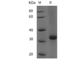 SDS-PAGE analysis of Human LEPR/CD295 proteins, 2 μg/lane of Recombinant Human LEPR/CD295 proteins was resolved with SDS-PAGE under reducing conditions, showing bands at 35 kDa.