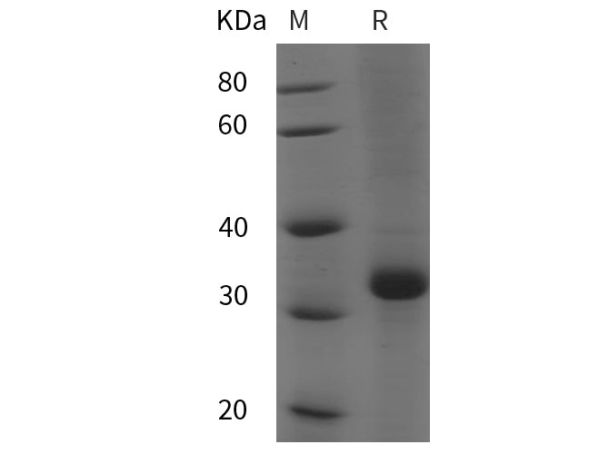 SDS-PAGE analysis of Human LEPR/CD295 proteins, 2 μg/lane of Recombinant Human LEPR/CD295 proteins was resolved with SDS-PAGE under reducing conditions, showing bands at 35 kDa.