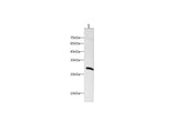 Anti-Human KLK10 Antibody - ABMIUM