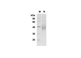 SDS-PAGE analysis of Mouse CD200 proteins , 2 μg/lane of Recombinant Mouse CD200 proteins was resolved with SDS-PAGE under reducing conditions , showing bands at 35-40 kDa.