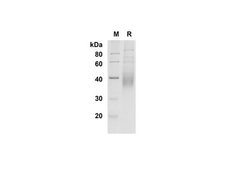 SDS-PAGE analysis of Mouse CD200 proteins , 2 μg/lane of Recombinant Mouse CD200 proteins was resolved with SDS-PAGE under reducing conditions , showing bands at 35-40 kDa.