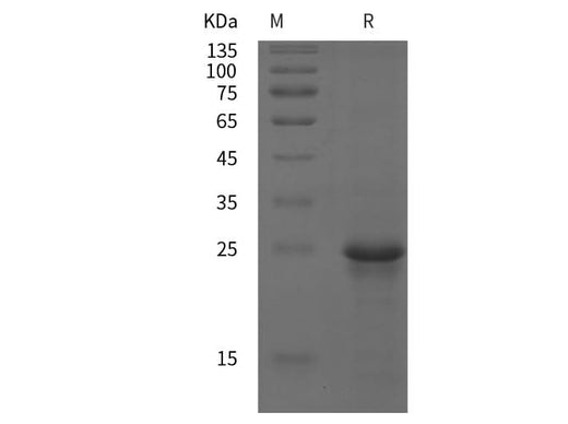 SDS-PAGE analysis of Human CD147/BSG/Basigin proteins, 2 μg/lane of Recombinant Human CD147/BSG/Basigin proteins was resolved with SDS-PAGE under reducing conditions, showing bands at 25 kDa.