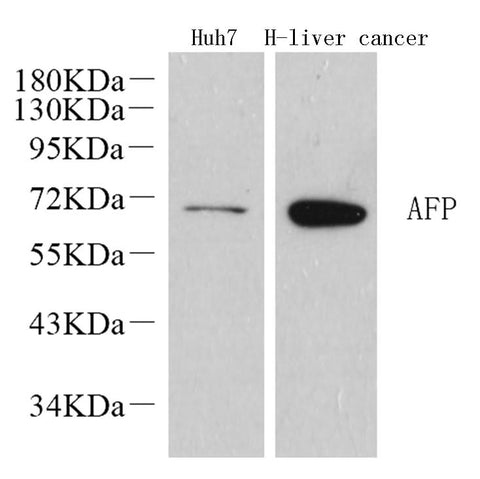 Western Blot analysis of various samples using AFP Polyclonal Antibody at dilution of 1:1000.