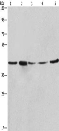 Anti-Human/Mouse/Rat RPSA Antibody - ABMIUM