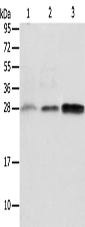 Anti-Human/Mouse ALKBH2 Antibody - ABMIUM