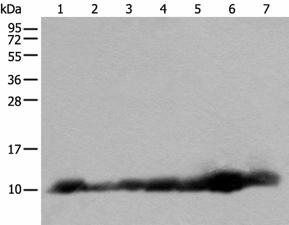 Western blot analysis of 293T and RAW264.7 cell Human fetal brain tissue Jurkat and 231 cell Human heart tissue Hela cell lysates using C14orf2 Polyclonal Antibody at dilution of 1:600
