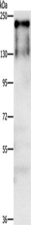 Anti-Human ATAD5 Antibody - ABMIUM