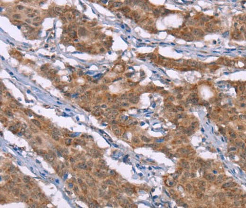 Anti-Human Histamine H3 Receptor Antibody - ABMIUM