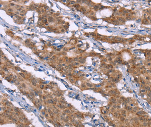 Anti-Human Histamine H3 Receptor Antibody - ABMIUM