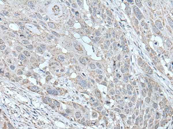 Anti-Human/Rat SCNN1G Antibody