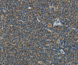 Anti-Human/Mouse PITX3 Antibody - ABMIUM