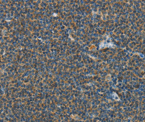 Anti-Human/Mouse PITX3 Antibody - ABMIUM