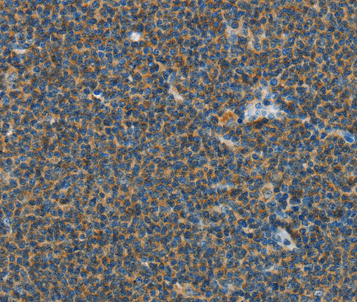 Anti-Human/Mouse PITX3 Antibody - ABMIUM
