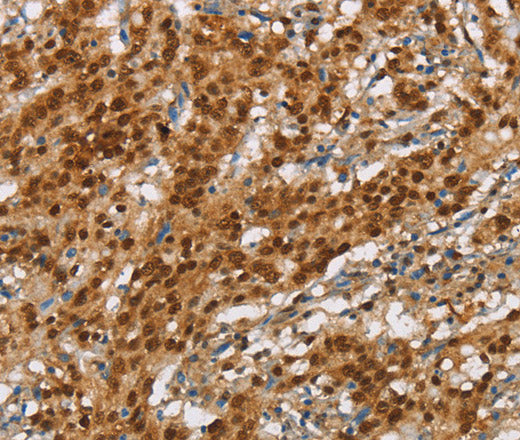 Anti-Human NLRP7 Antibody - ABMIUM