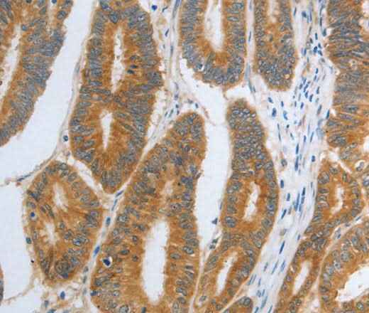 Anti-Human/Mouse/Rat RHEB Antibody