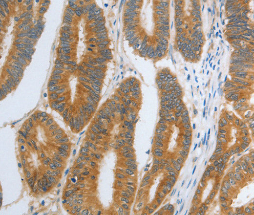 Anti-Human/Mouse/Rat RHEB Antibody - ABMIUM