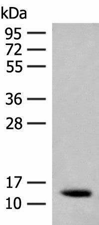 Western blot analysis of Human fetal brain tissue lysate using AKAP7 Polyclonal Antibody at dilution of 1:200