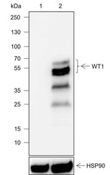 Anti-Human/Rat/Mouse WT1 Antibody [A742]