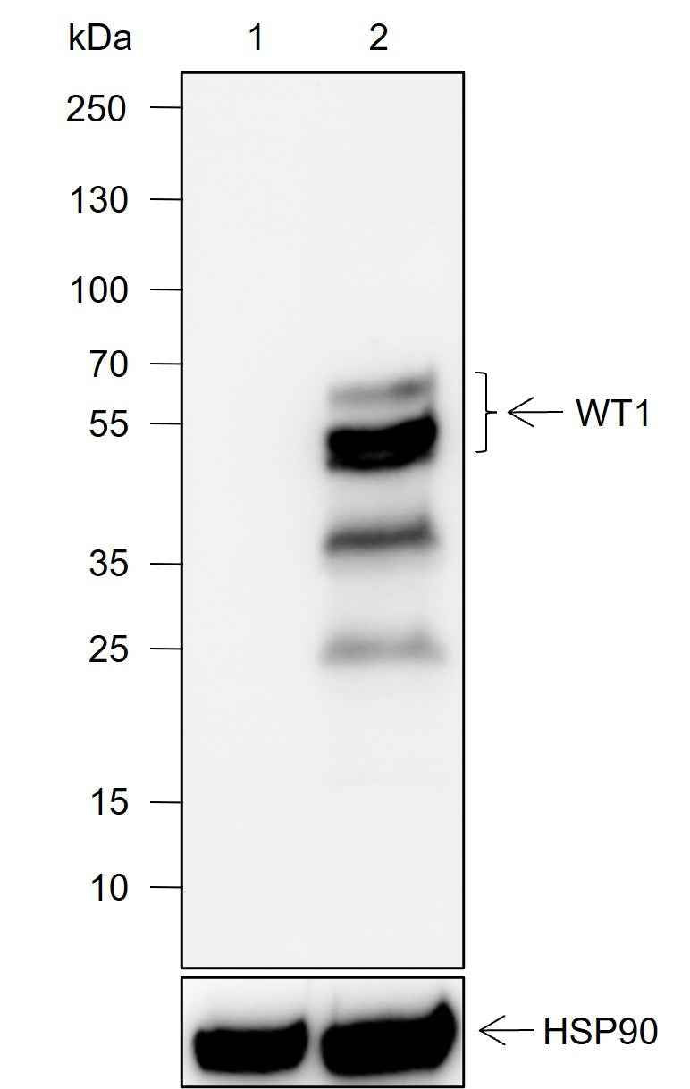 Anti-Human/Rat/Mouse WT1 Antibody [A742]