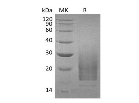 Recombinant Human Interleukin-3/IL-3 Protein (Human Cells, His Tag) - ABMIUM