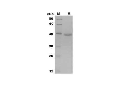 SDS-PAGE analysis of Mouse PⅢNP proteins, 2 μg/lane of Recombinant Mouse PⅢNP proteins was resolved with SDS-PAGE under reducing conditions, showing bands at 39 kDa.