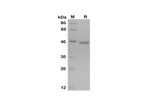 SDS-PAGE analysis of Mouse PⅢNP proteins, 2 μg/lane of Recombinant Mouse PⅢNP proteins was resolved with SDS-PAGE under reducing conditions, showing bands at 39 kDa.