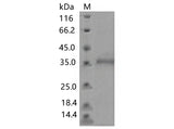 > 90 % as determined by reducing SDS-PAGE.
