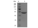SDS-PAGE analysis of Human ENO1 proteins, 2 μg/lane of Recombinant Human ENO1 proteins was resolved with SDS-PAGE under reducing conditions, showing bands at 60 kDa.