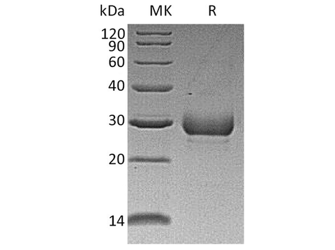Recombinant Human Noggin/NOG Protein - ABMIUM