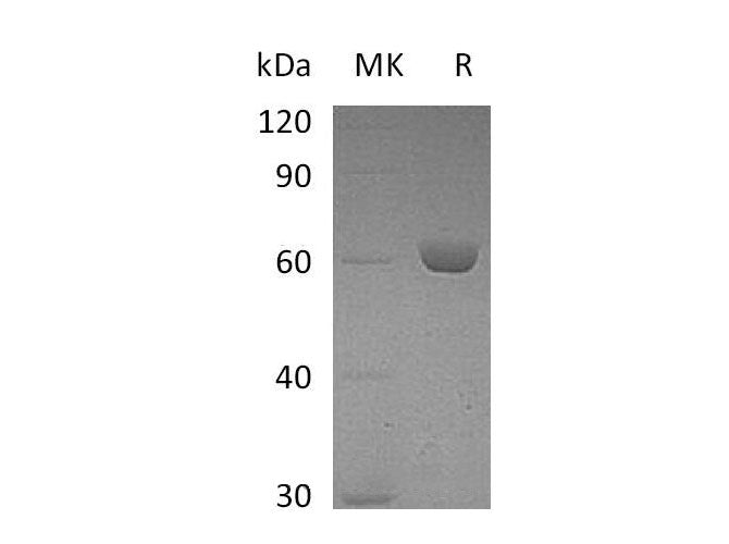 Recombinant Mouse Carboxylesterase 2E/CES2E Protein (His Tag) - ABMIUM