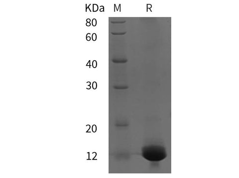 SDS-PAGE analysis of Rat RUNX2/CBFA1 proteins, 2 μg/lane of Recombinant Rat RUNX2/CBFA1 proteins was resolved with SDS-PAGE under reducing conditions, showing bands at 12 kDa.