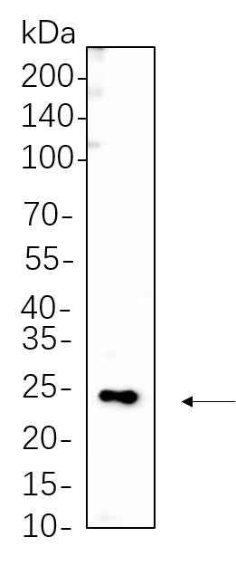Anti-Human/Mouse/Rat MYL9 Antibody [B1065] - ABMIUM