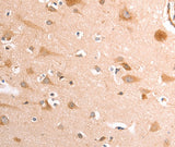 Anti-Human/Mouse/Rat TRPV4 Antibody - ABMIUM
