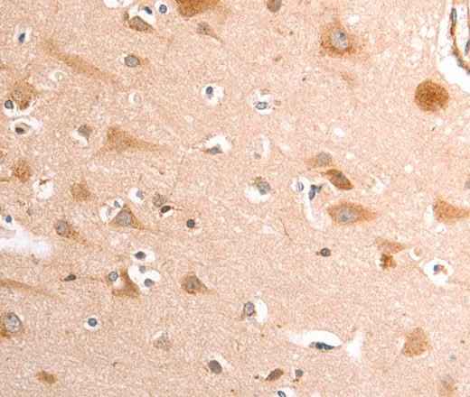 Anti-Human/Mouse/Rat TRPV4 Antibody