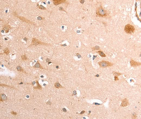 Anti-Human/Mouse/Rat TRPV4 Antibody - ABMIUM