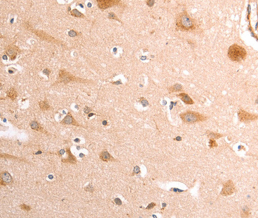 Anti-Human/Mouse/Rat TRPV4 Antibody - ABMIUM