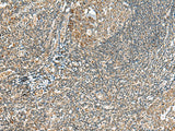 Immunohistochemistry of paraffin-embedded Human tonsil tissue using MOB2 Polyclonal Antibody at dilution of 1:40(×200)