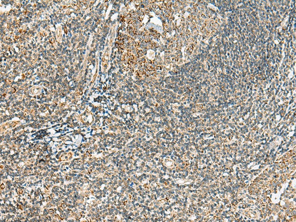 Immunohistochemistry of paraffin-embedded Human tonsil tissue using MOB2 Polyclonal Antibody at dilution of 1:40(×200)