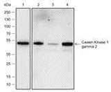 Anti-Human/Rat/Mouse Casein Kinase 1 gamma 2 Antibody [A544]
