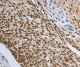 Anti-Human PRMT3 Antibody - ABMIUM