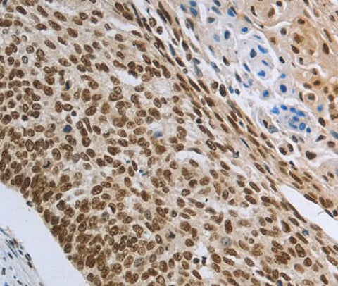 Anti-Human PRMT3 Antibody - ABMIUM
