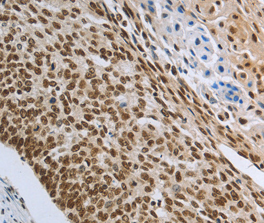 Anti-Human PRMT3 Antibody - ABMIUM